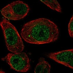 ZNF623 Antibody, Novus Biologicals:Antibodies:Primary Antibodies